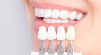 白い歯・セラミック治療